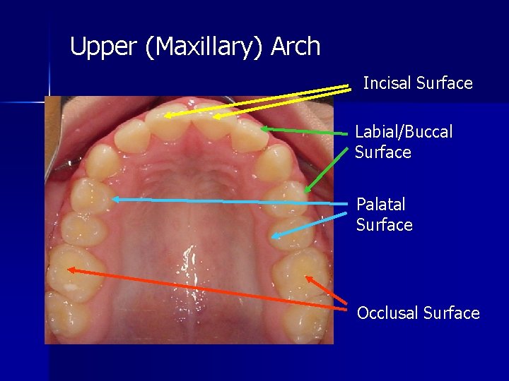 Upper (Maxillary) Arch Incisal Surface Labial/Buccal Surface Palatal Surface Occlusal Surface 