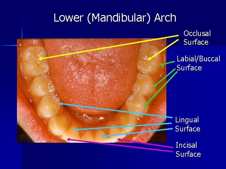 Lower (Mandibular) Arch Occlusal Surface Labial/Buccal Surface Lingual Surface Incisal Surface 