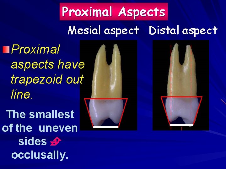 Proximal Aspects Mesial aspect Distal aspect Proximal aspects have trapezoid out line. The smallest