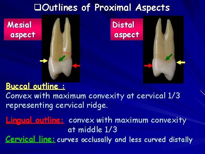 q. Outlines of Proximal Aspects Mesial aspect Distal aspect Buccal outline : Convex with