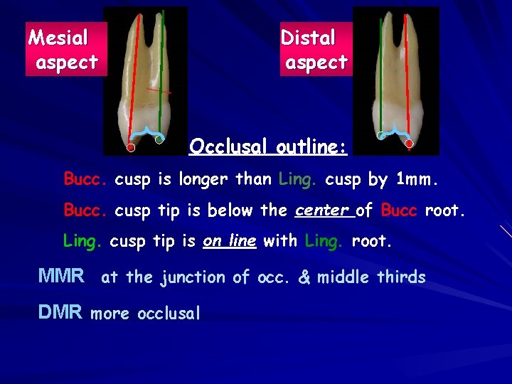 Distal aspect Mesial aspect Occlusal outline: Bucc. cusp is longer than Ling. cusp by