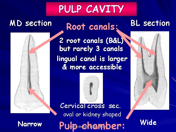 PULP CAVITY MD section Root canals: BL section 2 root canals (B&L) but rarely
