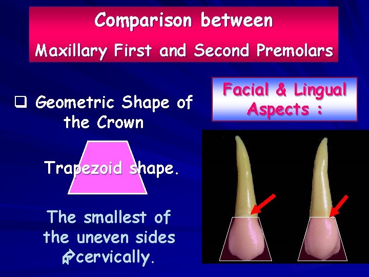 Comparison between Maxillary First and Second Premolars q Geometric Shape of the Crown Trapezoid