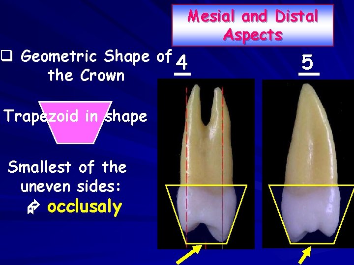 Mesial and Distal Aspects q Geometric Shape of 4 the Crown Trapezoid in shape