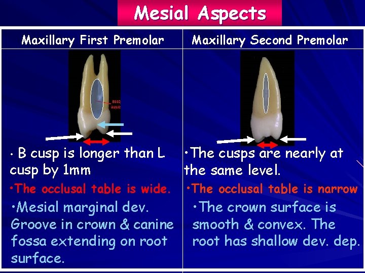 Mesial Aspects Maxillary First Premolar Maxillary Second Premolar B cusp is longer than L