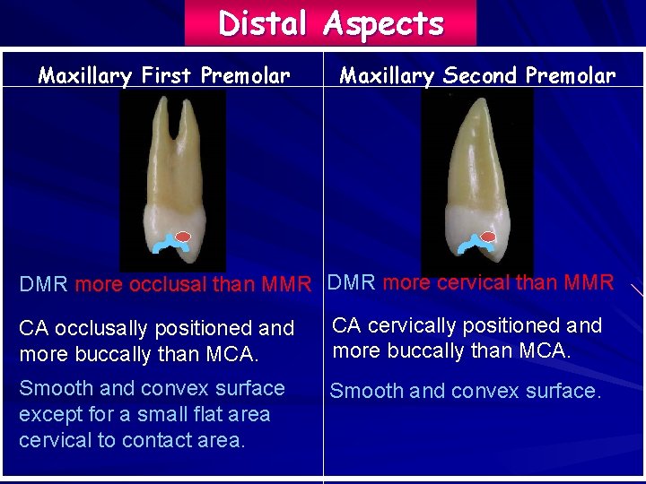 Distal Aspects Maxillary First Premolar Maxillary Second Premolar DMR more occlusal than MMR DMR