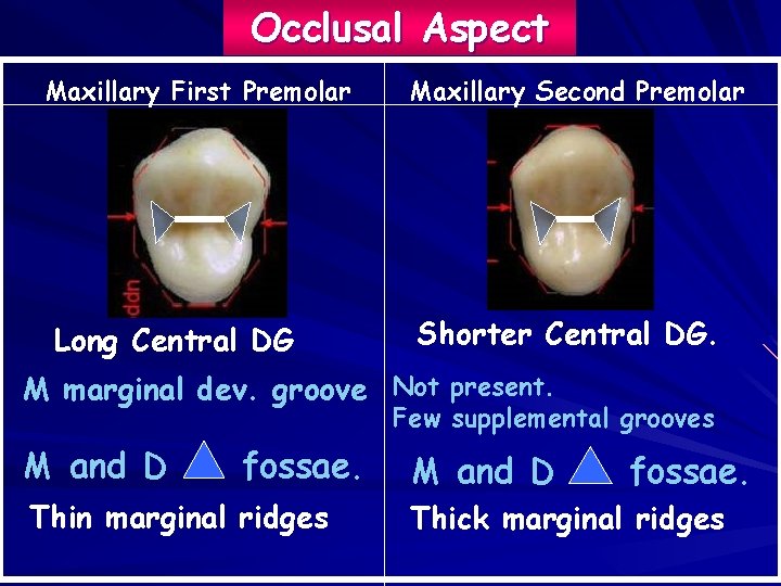 Occlusal Aspect Maxillary First Premolar Long Central DG Maxillary Second Premolar Shorter Central DG.