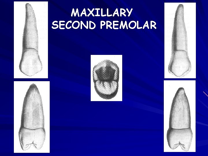 MAXILLARY SECOND PREMOLAR 
