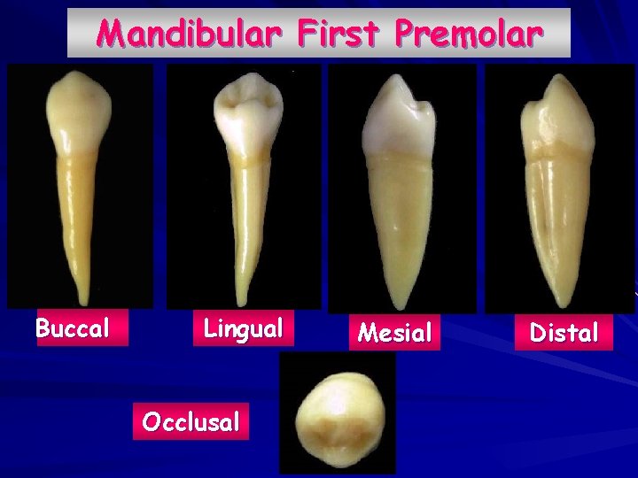 Mandibular First Premolar Buccal Lingual Occlusal Mesial Distal 