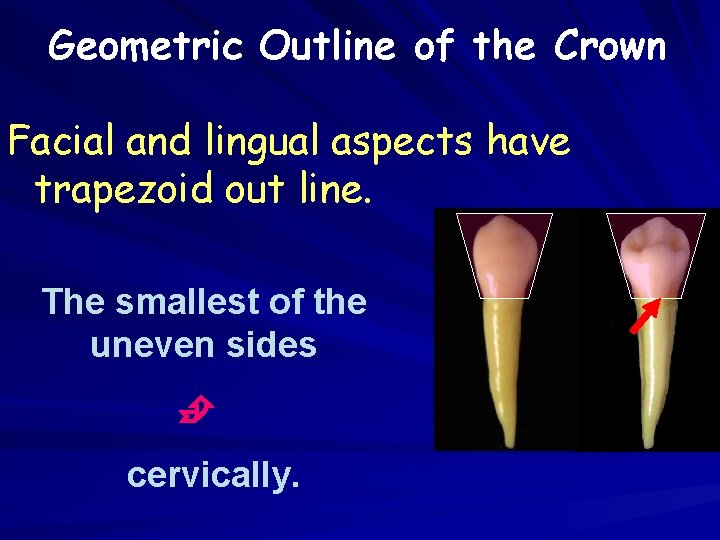 Geometric Outline of the Crown Facial and lingual aspects have trapezoid out line. The