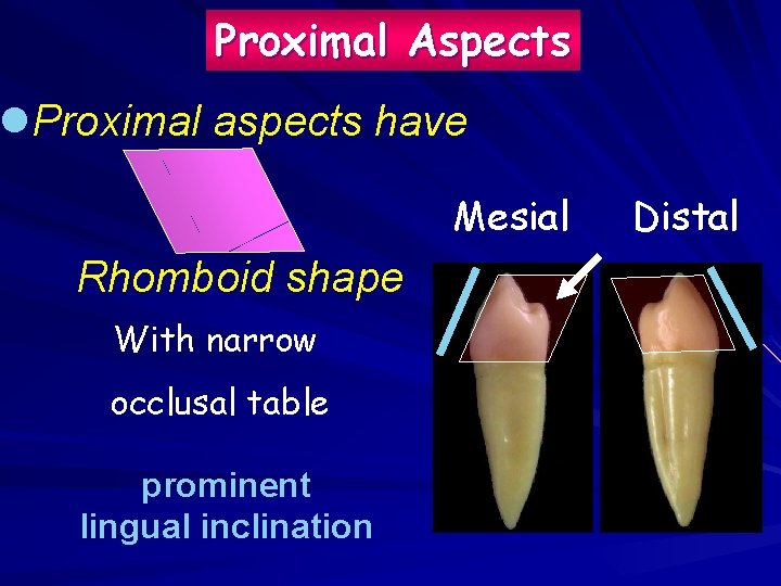 Proximal Aspects l. Proximal aspects have Mesial Rhomboid shape With narrow occlusal table prominent