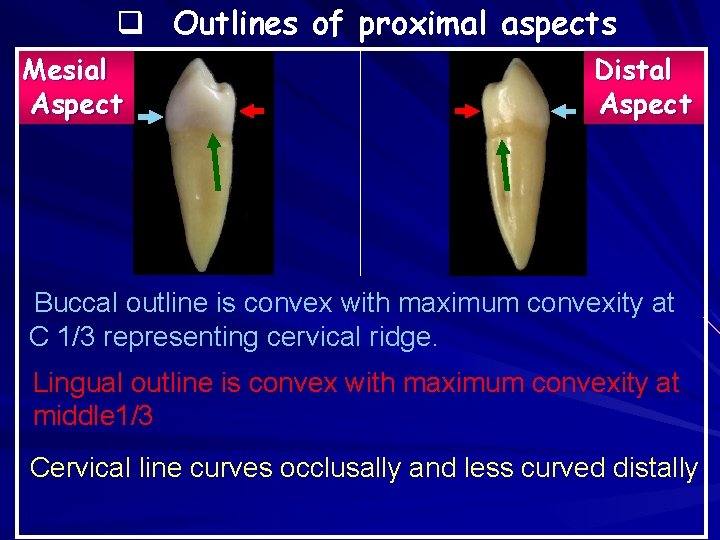 q Outlines of proximal aspects Mesial Aspect Distal Aspect Buccal outline is convex with