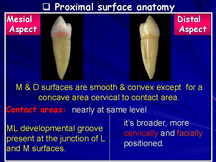 Mesial Aspect q Proximal surface anatomy Distal Aspect M & D surfaces are smooth