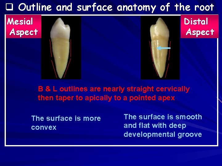q Outline and surface anatomy of the root Mesial Aspect Distal Aspect B &