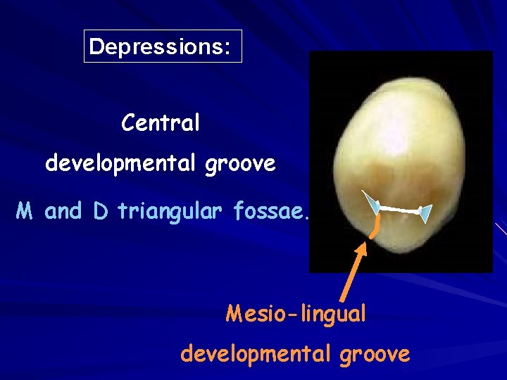 Depressions: Central developmental groove M and D triangular fossae. Mesio-lingual developmental groove 