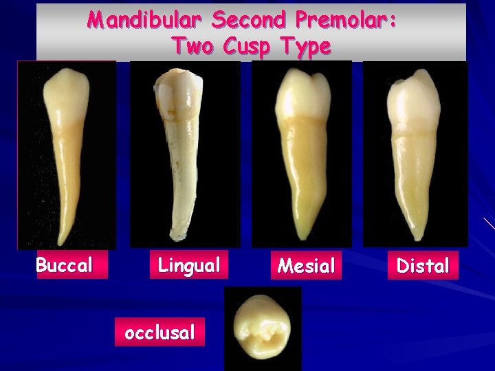Mandibular Second Premolar: Two Cusp Type Buccal Lingual occlusal Mesial Distal 