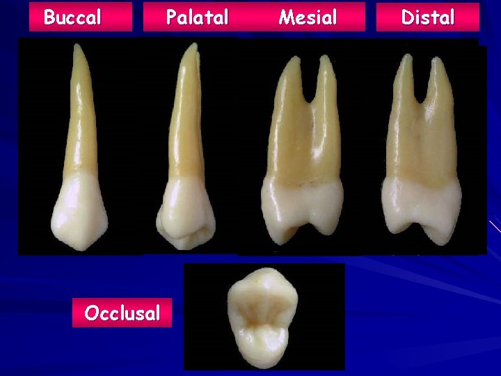 Buccal Palatal Mesial Occlusal www. rxdentistry. blogspot. com Distal 