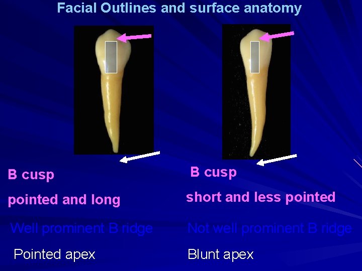Facial Outlines and surface anatomy B cusp pointed and long short and less pointed
