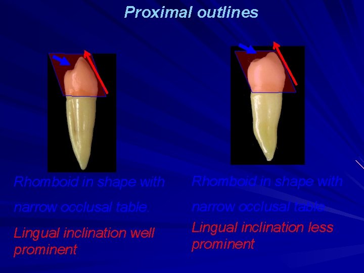 Proximal outlines Rhomboid in shape with narrow occlusal table. Lingual inclination less prominent Lingual