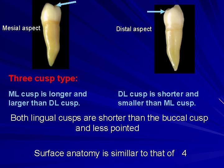 Mesial aspect Distal aspect Three cusp type: ML cusp is longer and larger than