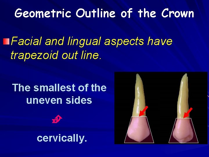 Geometric Outline of the Crown Facial and lingual aspects have trapezoid out line. The