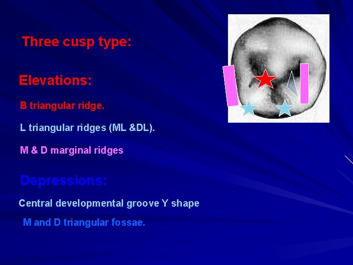 Three cusp type: Elevations: B triangular ridge. L triangular ridges (ML &DL). M &