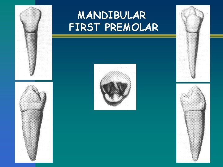MANDIBULAR FIRST PREMOLAR 