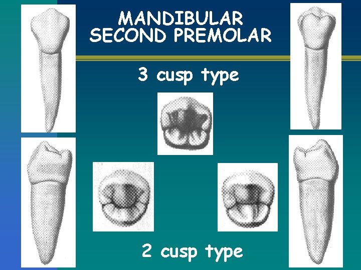 MANDIBULAR SECOND PREMOLAR 3 cusp type 2 cusp type 