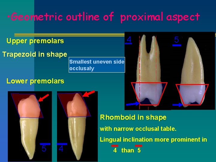  • Geometric outline of proximal aspect 4 Upper premolars 5 Trapezoid in shape