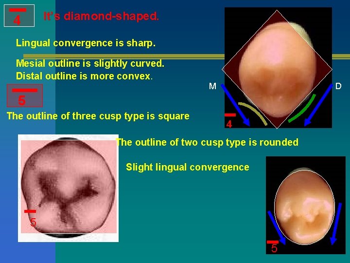It’s diamond-shaped. 4 Lingual convergence is sharp. Mesial outline is slightly curved. Distal outline