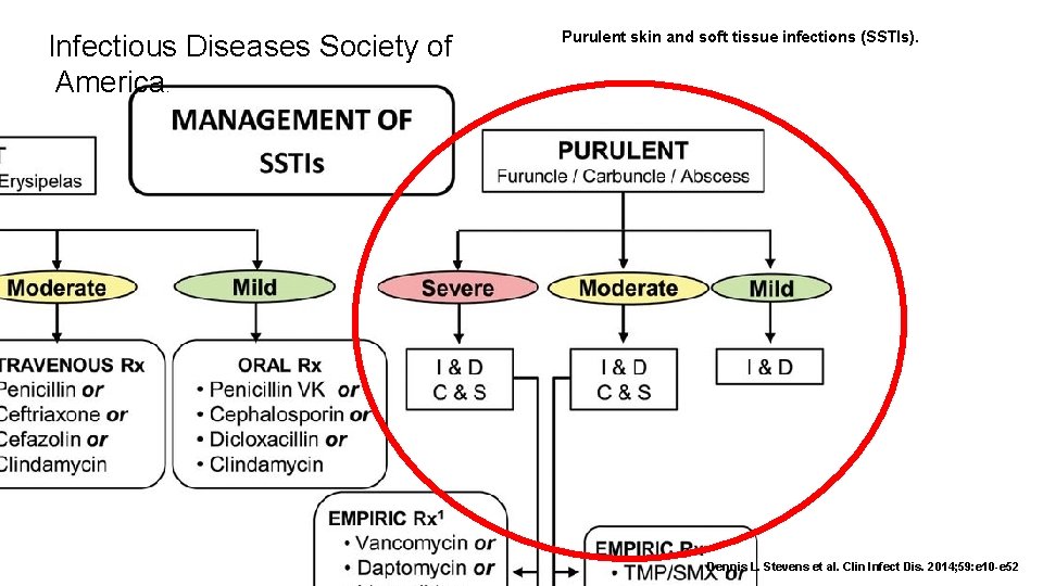 Infectious Diseases Society of America Purulent skin and soft tissue infections (SSTIs). . Dennis