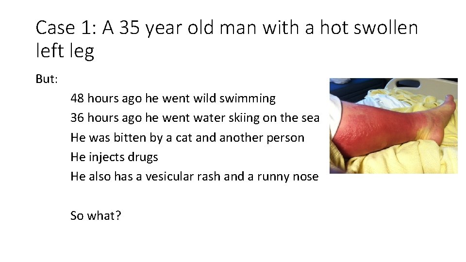 Case 1: A 35 year old man with a hot swollen left leg But: