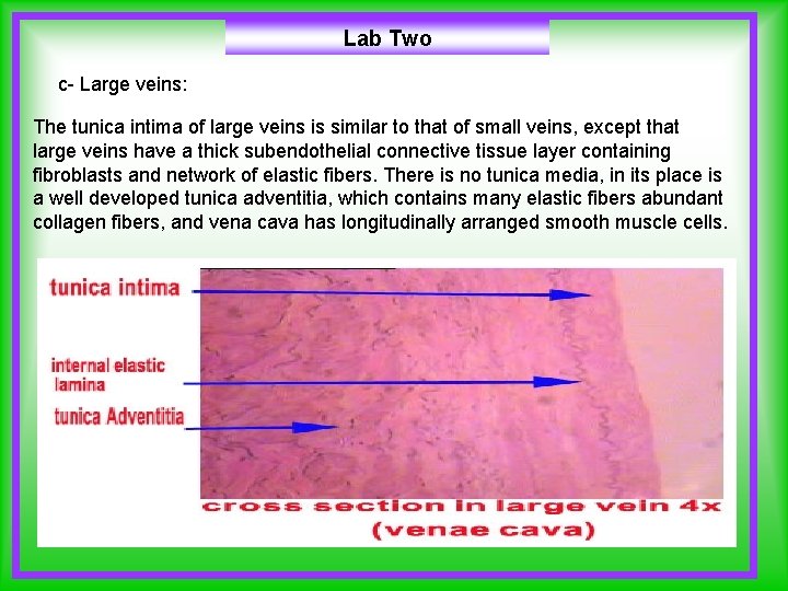 Lab Two c- Large veins: The tunica intima of large veins is similar to