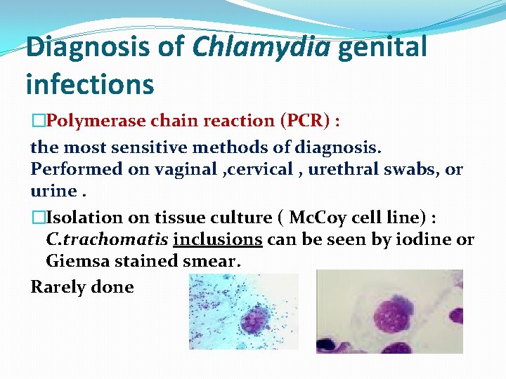 Diagnosis of Chlamydia genital infections �Polymerase chain reaction (PCR) : the most sensitive methods