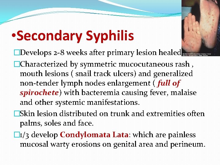  • Secondary Syphilis �Develops 2 -8 weeks after primary lesion healed. �Characterized by