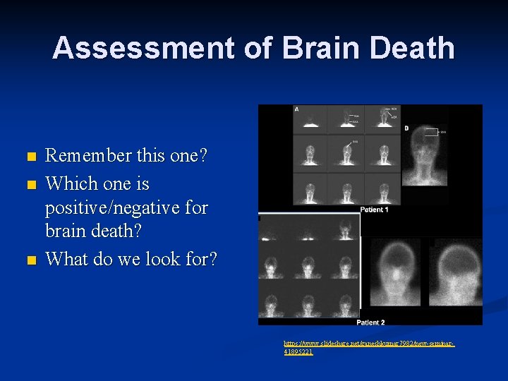 Assessment of Brain Death n n n Remember this one? Which one is positive/negative