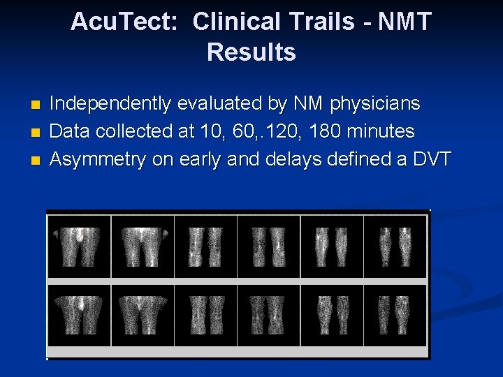 Acu. Tect: Clinical Trails - NMT Results n n n Independently evaluated by NM