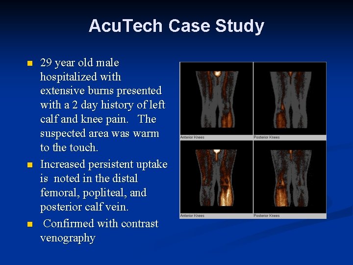 Acu. Tech Case Study n n n 29 year old male hospitalized with extensive