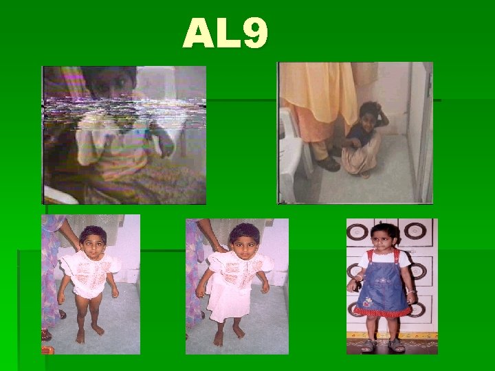 AL 9 