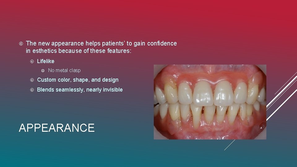  The new appearance helps patients’ to gain confidence in esthetics because of these