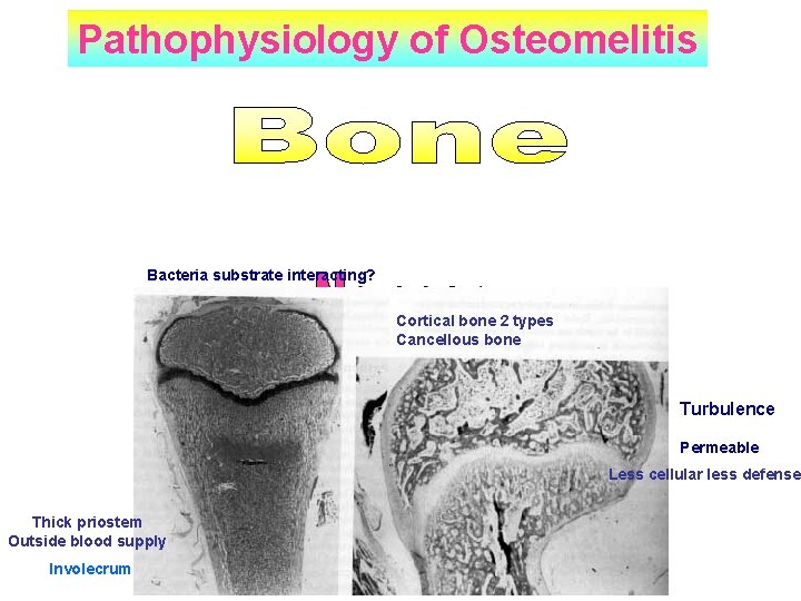 Pathophysiology of Osteomelitis Bacteria substrate interacting? Cortical bone 2 types Cancellous bone Turbulence Permeable