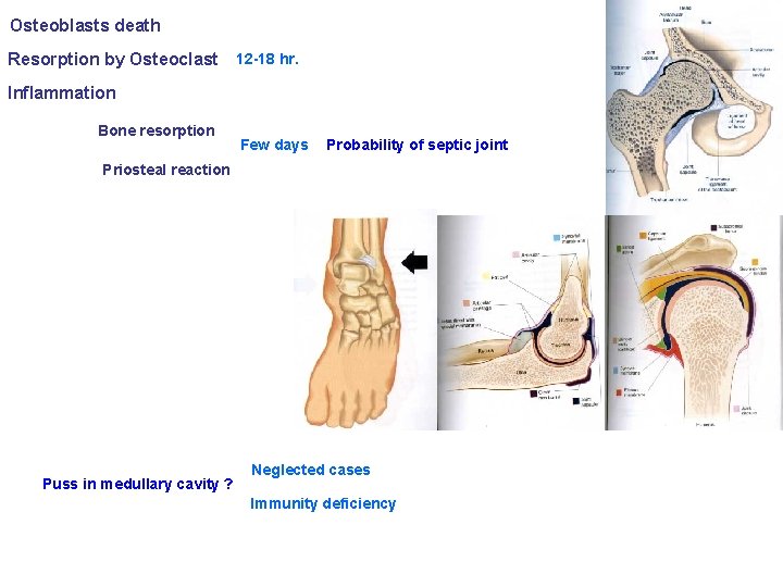 Osteoblasts death Resorption by Osteoclast 12 -18 hr. Inflammation Bone resorption Few days Probability