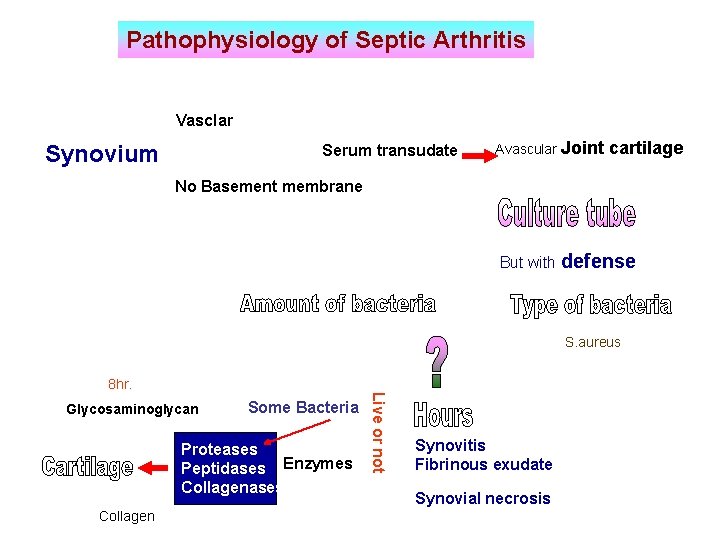 Pathophysiology of Septic Arthritis Vasclar Synovium Serum transudate Avascular Joint cartilage No Basement membrane
