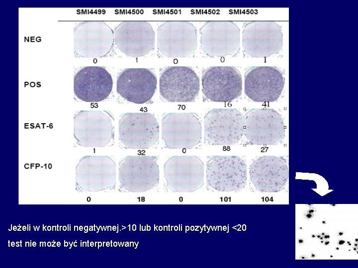 Jeżeli w kontroli negatywnej. >10 lub kontroli pozytywnej <20 test nie może być interpretowany