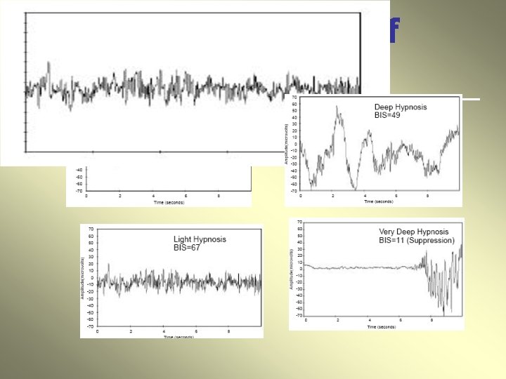 idealized pattern of changes in the EEG 