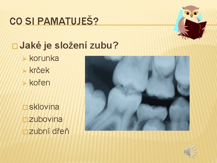 CO SI PAMATUJEŠ? � Jaké je složení zubu? korunka Ø krček Ø kořen Ø