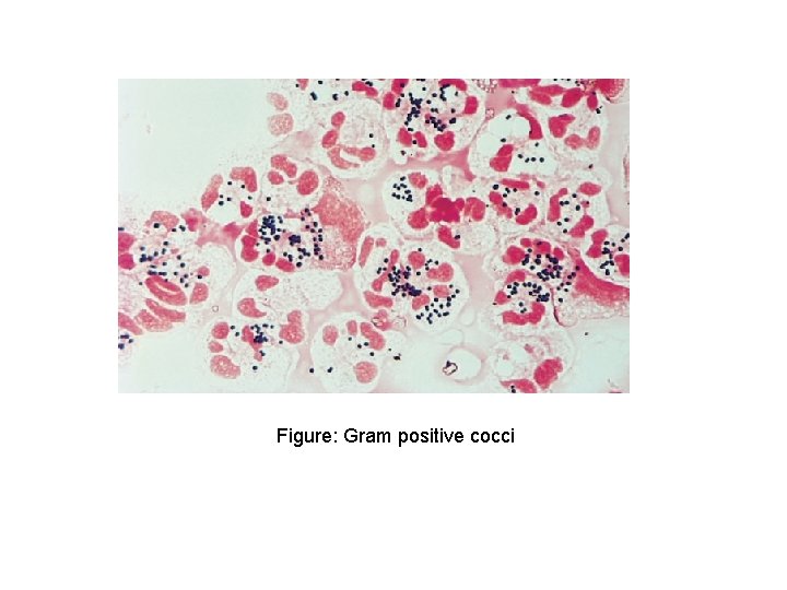 Figure: Gram positive cocci 