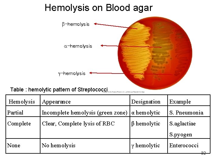 Hemolysis on Blood agar -hemolysis Table : hemolytic pattern of Streptococci Hemolysis Appearance Designation