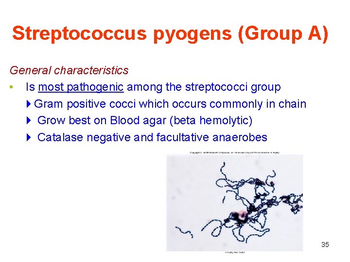 Streptococcus pyogens (Group A) General characteristics • Is most pathogenic among the streptococci group