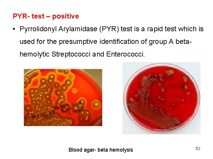 PYR- test – positive • Pyrrolidonyl Arylamidase (PYR) test is a rapid test which